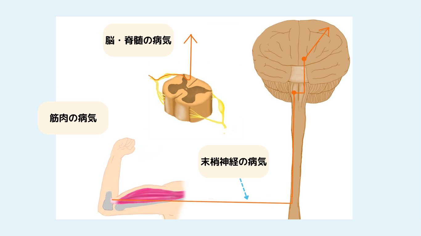 脳神経内科の領域